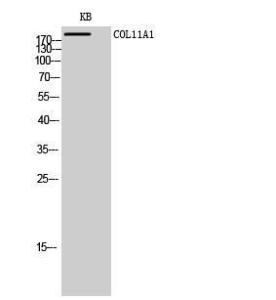 Western blot analysis of KB cells using Anti-Collagen XI alpha1 Antibody