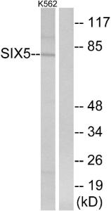 Western blot analysis of lysates from K562 cells using Anti-SIX5 Antibody. The right hand lane represents a negative control, where the Antibody is blocked by the immunising peptide