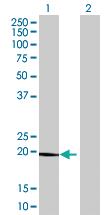 Anti-CLEC3B Mouse Polyclonal Antibody