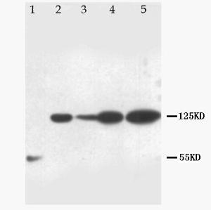 Anti-Notch1 Rabbit Polyclonal Antibody