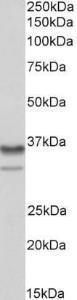 Anti-HNRNPA2B1 Antibody (A82904) (0.01 µg/ml) staining of NIH3T3 nuclear lysate (35 µg protein in RIPA buffer). Primary incubation was 1 hour. Detected by chemiluminescence