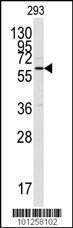 Anti-CAMK2A Rabbit Polyclonal Antibody (AP (Alkaline Phosphatase))