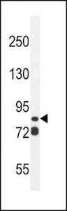 Anti-ASAP3 Rabbit Polyclonal Antibody (AP (Alkaline Phosphatase))