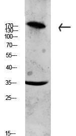 Western blot analysis of CACO2 lysate using Anti-Collagen XI alpha1 Antibody