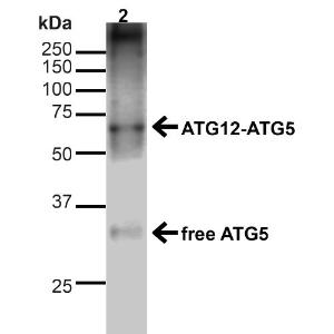 Western blot analysis of human Cervical cancer cell line (HeLa) lysate showing detection of ~15kDa ATG5 protein using Anti-ATG5 Antibody (A304901) at 1:1,000 for 1 hour at room temperature