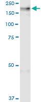 Anti-CNTNAP2 Rabbit Polyclonal Antibody