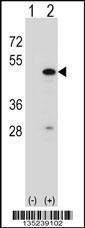 Anti-RBM22 Rabbit Polyclonal Antibody (Biotin)