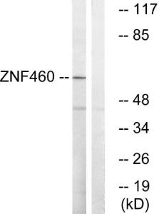 Western blot analysis of lysates from LOVO cells using Anti-ZNF460 Antibody. The right hand lane represents a negative control, where the antibody is blocked by the immunising peptide.