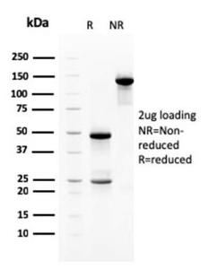 SDS-PAGE analysis of Anti-Heregulin Antibody [NRG1/2710] under non-reduced and reduced conditions; showing intact IgG and intact heavy and light chains, respectively. SDS-PAGE analysis confirms the integrity and purity of the antibody.