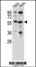 Anti-CSAD Rabbit Polyclonal Antibody