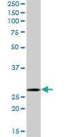 Anti-MRPL28 Mouse Polyclonal Antibody