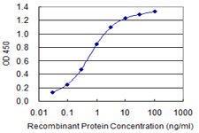 Anti-KIT Mouse Monoclonal Antibody [clone: 5F6]