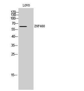 Western blot analysis of LOVO cells using Anti-ZNF460 Antibody