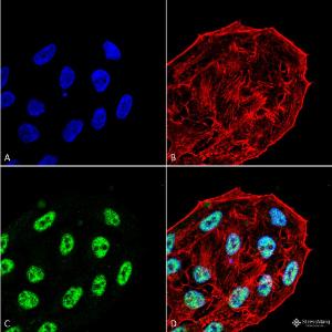 Immunocytochemistry/Immunofluorescence analysis of human cervical cancer cell line (HeLa), fixed in 4% formaldehyde for 15 min at room temperature, using Anti-ATG5 Antibody (A304901), at 1:100 for 60 minutes at room temperature