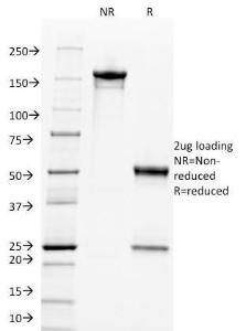 Antibody anti-C-MYC 9E11 100 µg