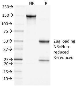 SDS-PAGE analysis of Anti-Clathrin Heavy Chain Antibody [CHC/1432] under non-reduced and reduced conditions; showing intact IgG and intact heavy and light chains, respectively. SDS-PAGE analysis confirms the integrity and purity of the antibody