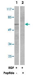 Anti-OPRM1 Rabbit Polyclonal Antibody