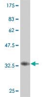 Anti-UBTF Mouse Monoclonal Antibody [clone: 1A2]