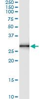 Anti-LIN28 Polyclonal Antibody Pair