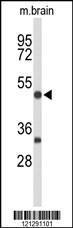 Anti-MEF2A Rabbit Polyclonal Antibody (AP (Alkaline Phosphatase))