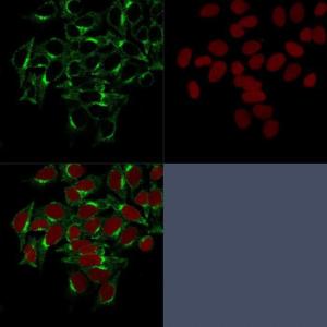 Immunofluorescent analysis of HeLa cells stained with Anti-Clathrin Heavy Chain Antibody [CHC/1432] followed by Goat Anti-Mouse IgG (CFand#174; 488) (Green). Nuclei are stained with RedDot