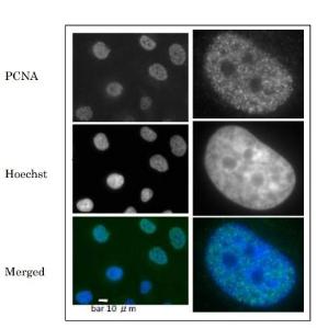 Anti-PCNA Antibody