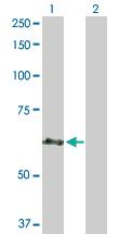 Anti-CEP57 Rabbit Polyclonal Antibody