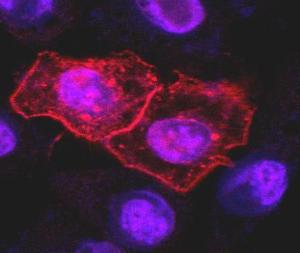 Immunofluorescence staining (confocal microscopy) of HeLa human cervix carcinoma cell line transfected with TRAIL-R1 expression plasmid using Anti-CD261 Antibody (A86116)