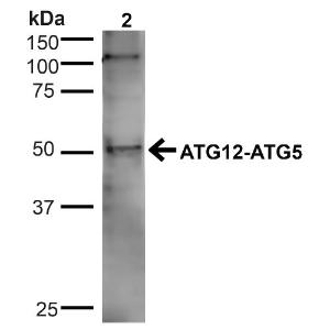 Western blot analysis of human Cervical cancer cell line (HeLa) lysate showing detection of ~32.4kDa ATG5 protein using Anti-ATG5 Antibody (A304902) at 1:1000 for 1 hour at room temperature. Lane 1: MW Ladder. Lane 2: human HeLa (20 µg)