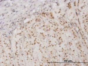 Anti-EIF2AK2 Mouse Monoclonal Antibody [clone: 1D11]