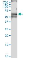 Anti-CCT7 Rabbit Polyclonal Antibody