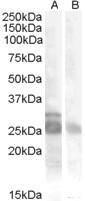 Anti-MYF5 Antibody (A84507) (0.5µg/ml) staining of Muscle lysate (35µg protein in RIPA buffer) with (B) and without (A) blocking with the immunising peptide. Primary incubation was 1 hour. Detected by chemiluminescence.