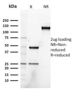 SDS-PAGE analysis of Anti-Heregulin Antibody [NRG1/2752] under non-reduced and reduced conditions; showing intact IgG and intact heavy and light chains, respectively. SDS-PAGE analysis confirms the integrity and purity of the antibody