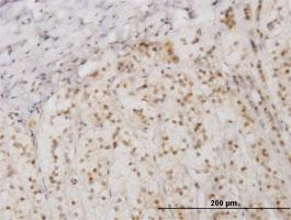 Anti-EIF2AK2 Mouse Monoclonal Antibody [clone: 1D11]