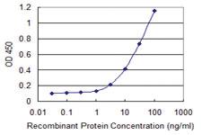 Anti-VNN1 Mouse Monoclonal Antibody [clone: 4E11]