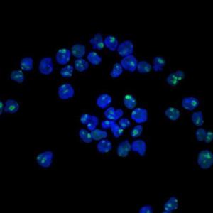 Immunofluorescent staining of HeLa cells stained with Anti-Nucleolin Antibody [NCL/902] (AF488) (Green). DAPI was used to stain the cell nuclei (Blue)