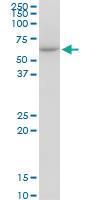 Anti-CCT7 Mouse Monoclonal Antibody [clone: 1D6]