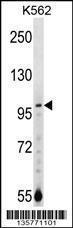 Anti-NAA15 Rabbit Polyclonal Antibody (FITC (Fluorescein Isothiocyanate))