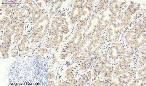 Immunohistochemical analysis of paraffin-embedded human stomach tissue using Anti-Smad2 + Smad3 Antibody at 1:200 (4°C overnight). Negative control was secondary antibody only.