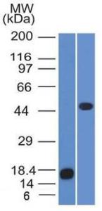 Western blot analysis of recombinant Adipophilin protein and Jurkat cell lysate using Anti-Adipophilin Antibody [ADFP/1365]