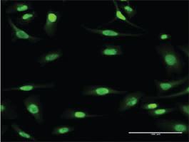 Anti-MCM3 Mouse Monoclonal Antibody [clone: 2H3]