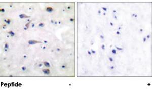 Anti-OPRM1 Rabbit Polyclonal Antibody