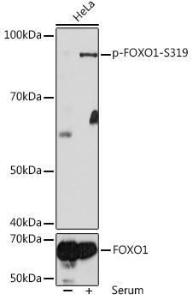 Western blot analysis of extracts of HeLa cells, using Anti-FOXO1A (phospho Ser319) Antibody (A308977) at 1:1000 dilution or FOXO1 antibody (A13862)