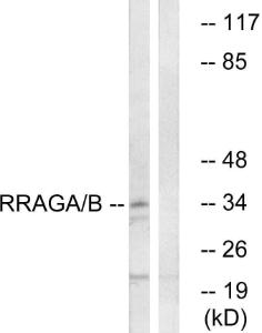 Western blot analysis of lysates from HepG2 cells using Anti-RRAGA + RRAGB Antibody. The right hand lane represents a negative control, where the antibody is blocked by the immunising peptide