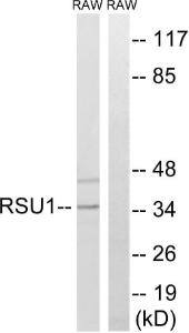 Anti-RSU1 [EPR16127] Rabbit Polyclonal Antibody