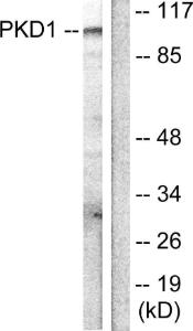 Western blot analysis of lysates from HUVEC cells, treated with PMA 125ng/ml 30' using Anti-PKC mu Antibody. The right hand lane represents a negative control, where the antibody is blocked by the immunising peptide