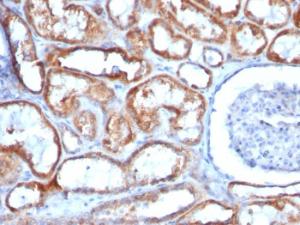 Immunohistochemical analysis of formalin-fixed, paraffin-embedded human renal cell carcinoma using Anti-Mitochondria Antibody [113-1]