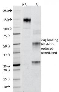 SDS-PAGE analysis of Anti-Adipophilin Antibody [ADFP/1365] under non-reduced and reduced conditions; showing intact IgG and intact heavy and light chains, respectively. SDS-PAGE analysis confirms the integrity and purity of the antibody