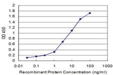 Anti-MCM3 Mouse Monoclonal Antibody [clone: 2H3]