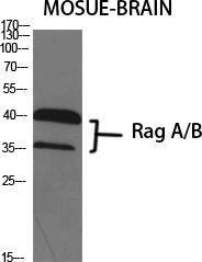 Western blot analysis of various cells using Anti-RRAGA + RRAGB Antibody